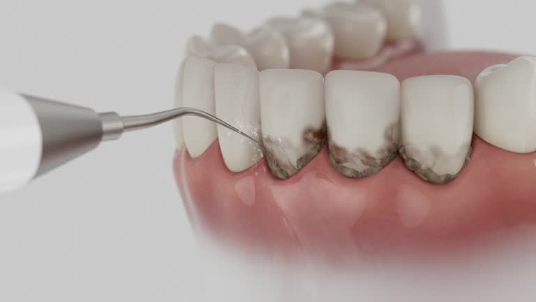 Trusted Teeth Cleaning And Checkup service in Kincaid, IL - Dentist Open Now
